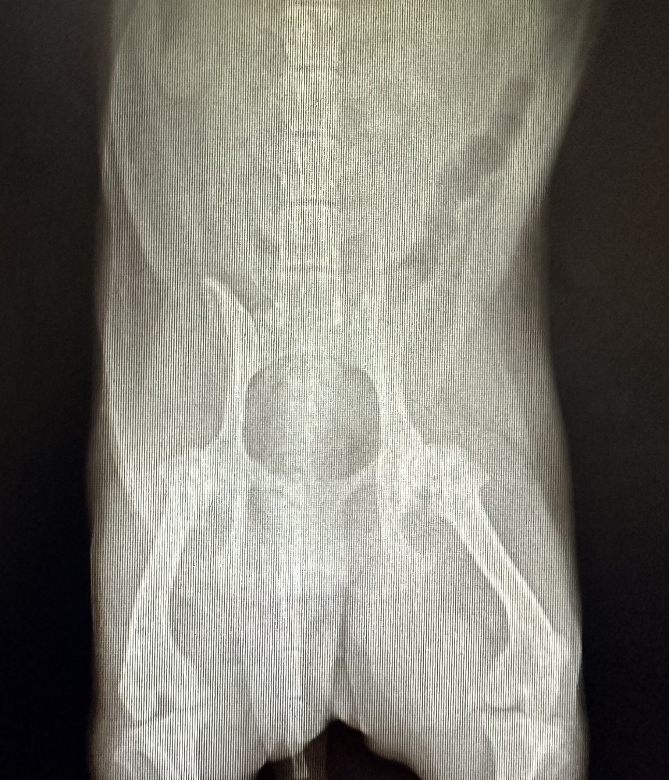 Radiograph